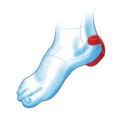 MS59 Heel Protector Επίθεμα φτέρνας